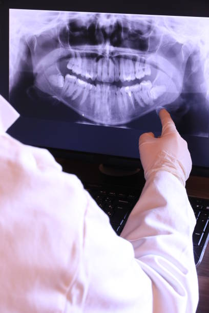Best Broken or Chipped Tooth Repair in Colony Rk, PA